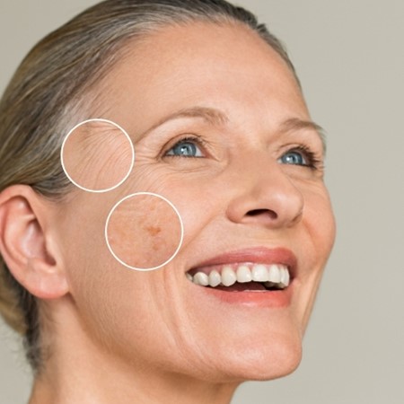 Sonnenschäden vorbeugen & lindern – mit professioneller Hautpflege